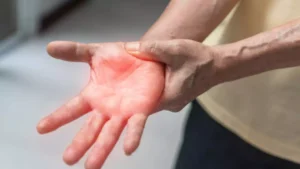 First Death Due to Guillain-Barré Syndrome in Pune: 101 Active Cases, 19 Children